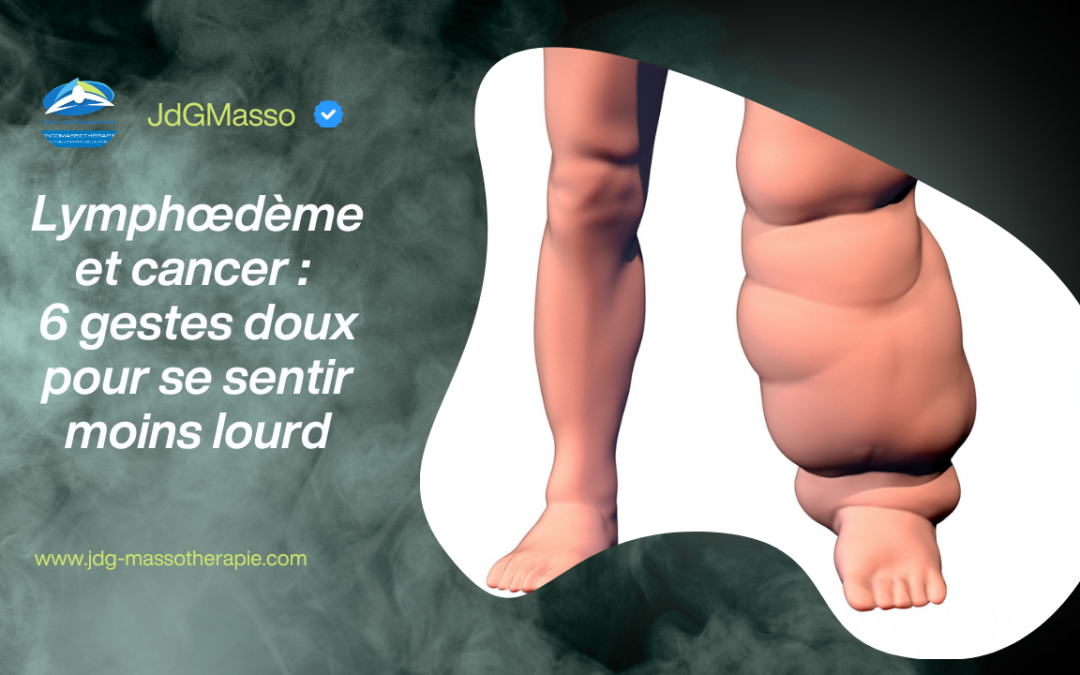 Lymphœdème et cancer : 6 gestes doux pour se sentir moins lourd