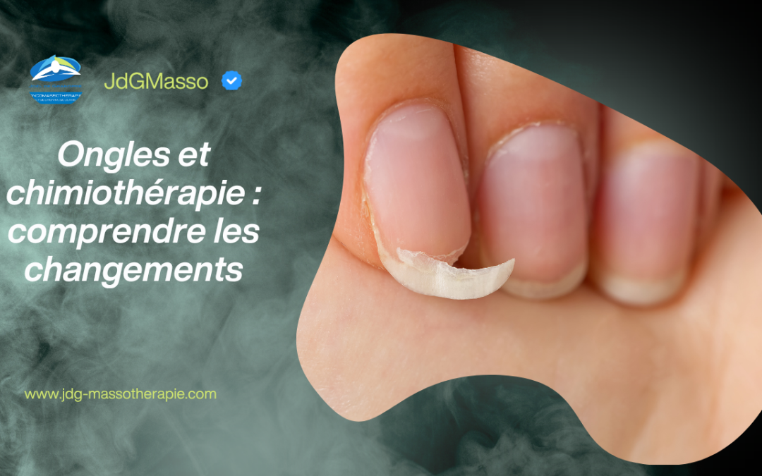 Illustration d’un ongle fragilisé et dédoublé, représentant les changements pouvant survenir aux ongles pendant une chimiothérapie.