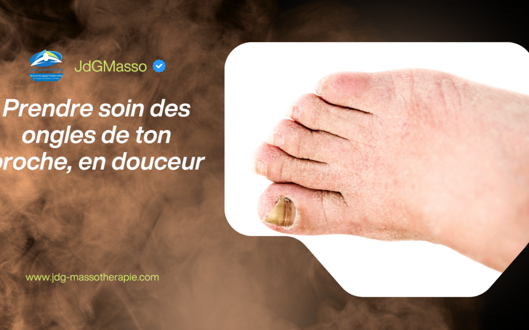Gros plan d’un pied montrant des ongles épaissis et jaunâtres ainsi qu’une peau sèche, illustrant l’importance de prendre soin des ongles d’un proche atteint de cancer avec douceur et précaution.
